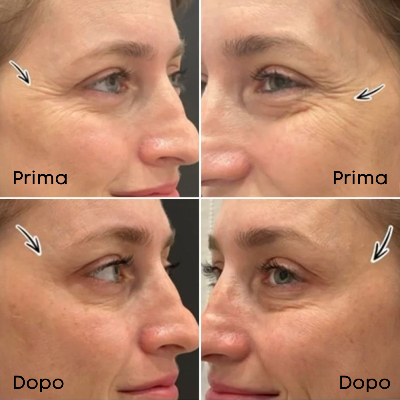 Cactus Stick - Trattamento Pori e Rughe, Finish Opaco