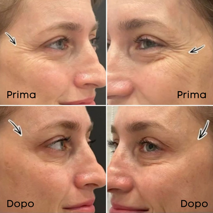 Cactus Stick - Trattamento Pori e Rughe, Finish Opaco