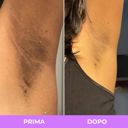 Spray Esfoliante Arelia