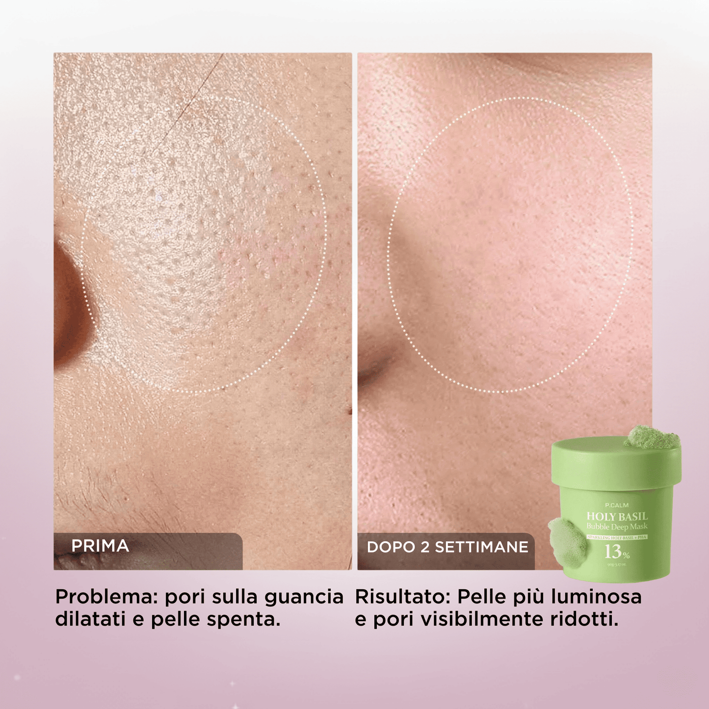 Bubble Mask: Pelle Di Porcellana, Luminosa e Levigata