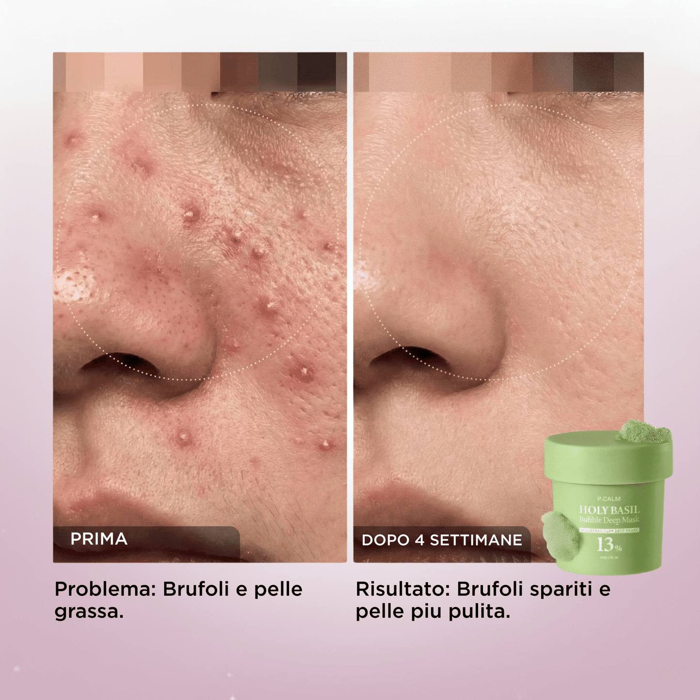 Bubble Mask: Pelle Di Porcellana, Luminosa e Levigata