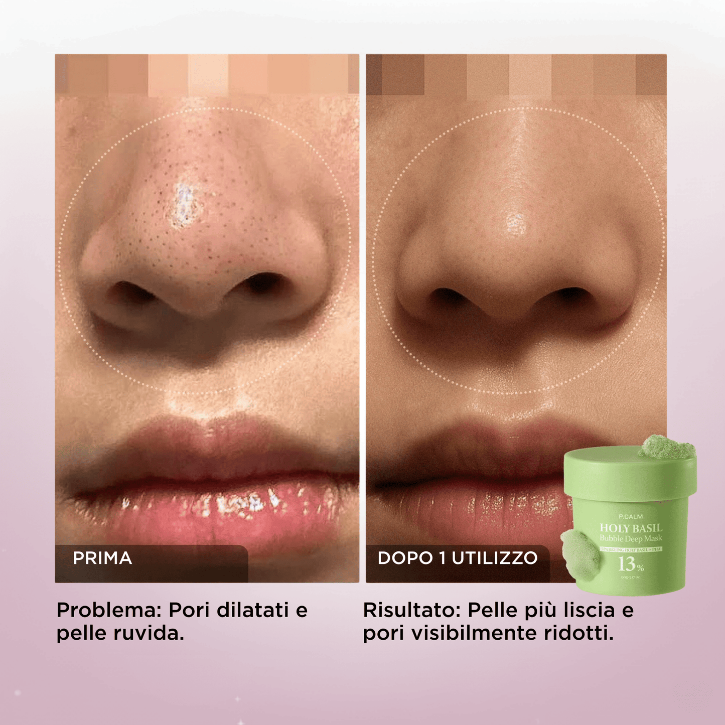 Bubble Mask: Pelle Di Porcellana, Luminosa e Levigata